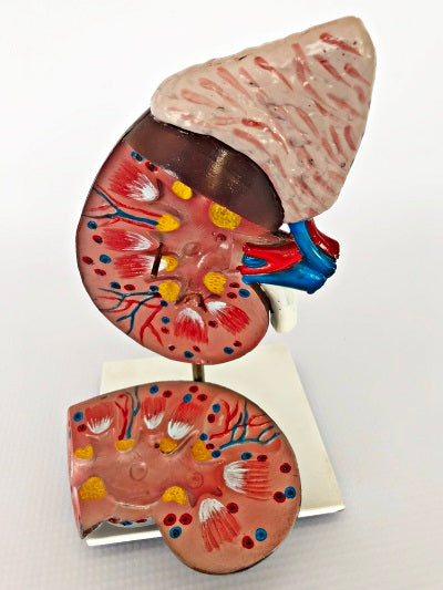 Kidney – 2-part IT050 3