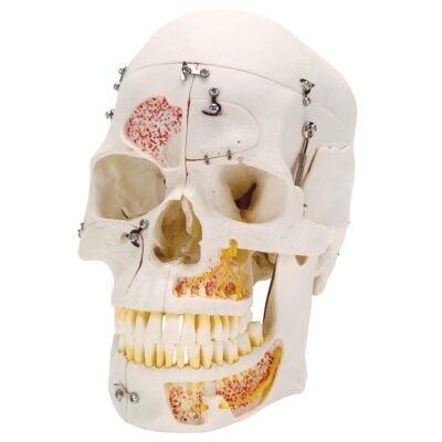 Deluxe Demonstration Skull 10 Part A27 1