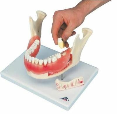 Dental Disease D26 1