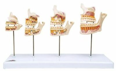 Dentition Development D20 1