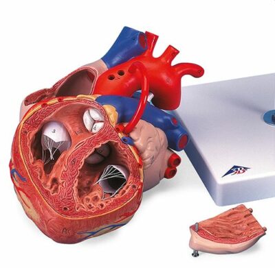 Heart with Bypass – 2times Life S – 4 Part G06 3