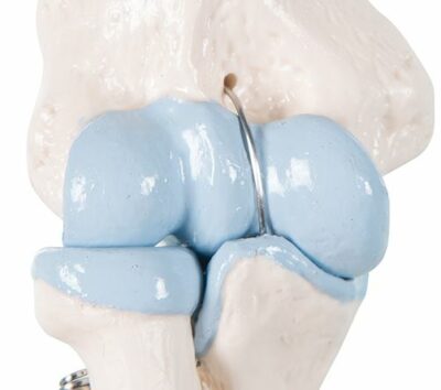 Mini Elbow Joint With Cross A87/1 3