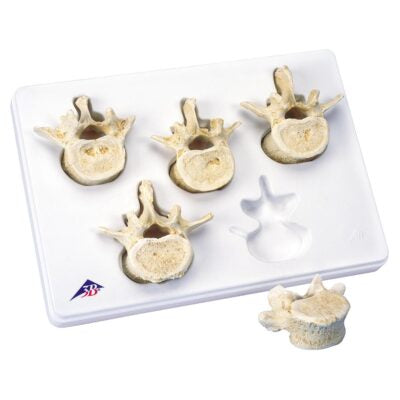 Set of 5 lumbar vertebrae A792 1