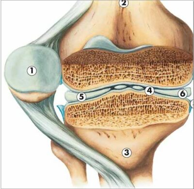 Arthritis Chart VR1123 2