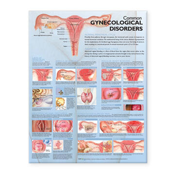 Common Gynecological Disorders