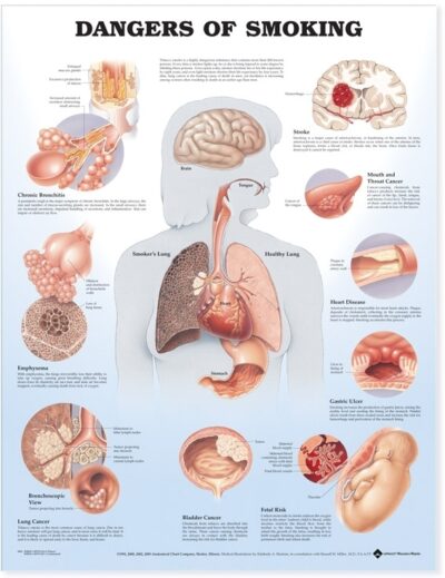 Dangers of Smoking Anatomical Chart 9865 1