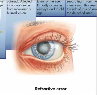 Diseases of the Eye Chart VR1231 1