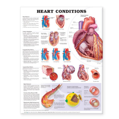Heart Conditions 8824 1