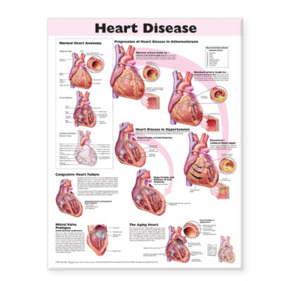 Heart Disease Anatomical Chart 9912 1