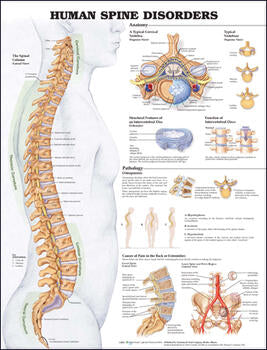 Human Spine Disorders