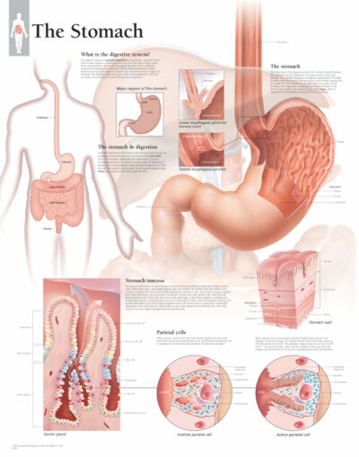Stomach 1501 1