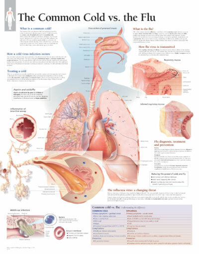 The Common Cold vs. the Flu 1356 1