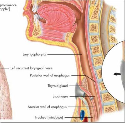 The Larynx Chart VR1248 1