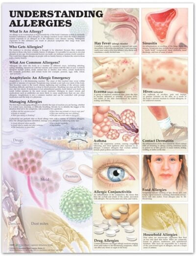 Understanding Allergies Anatomical Chart 9864 1