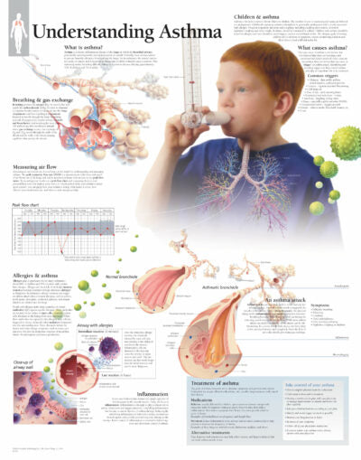 Understanding Asthma 1350 1