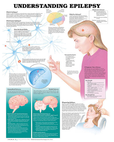 Understanding Epilepsy Anatomical Chart 9867 1
