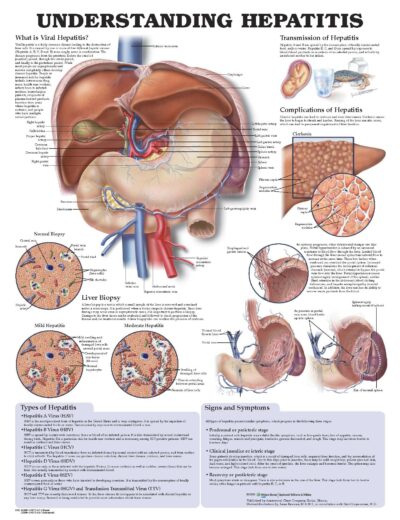 Understanding Hepatitis Anatomical Chart 9992 1