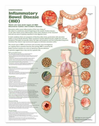 Understanding Inflammatory Bowel Disease 1