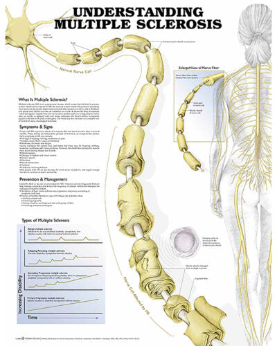 Understanding Multiple Sclerosis Anatomical Chart 9716 1