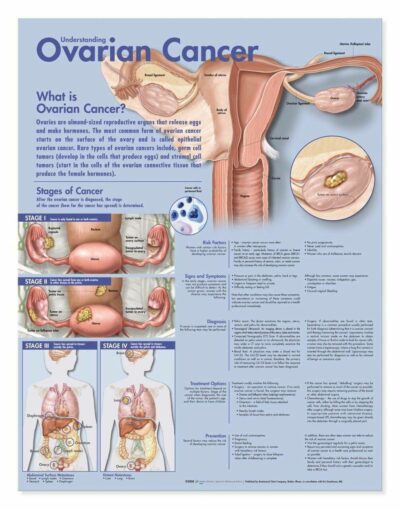 Understanding Ovarian Cancer 1