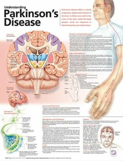 Understanding Parkinson’s Disease Anatomical Chart 9978 1