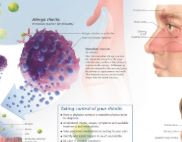 Understanding Rhinitis 1353 3