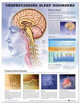 Understanding Sleep Disorders