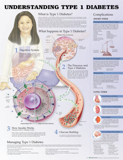 Understanding Type 1 Diabetes Anatomical Chart 9754 1