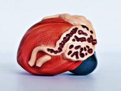 Expansion of Bladder Model IT055 1