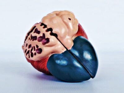 Expansion of Bladder Model IT055 3