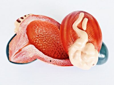 Expansion of Bladder Model IT055 2