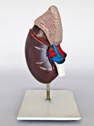 Kidney – 2-part IT050 1