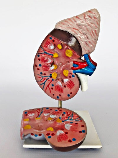 Kidney – 2-part IT050 2