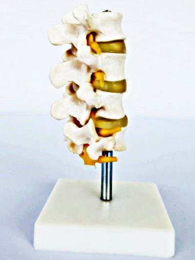 Lumbar Set (4 Pcs) IT018 2