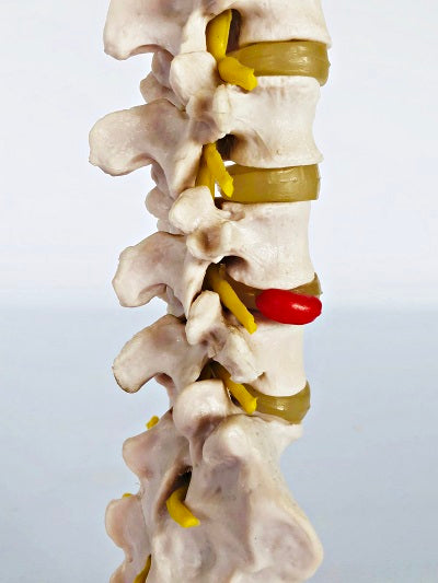 Lumbar Spine on stand IT019 1