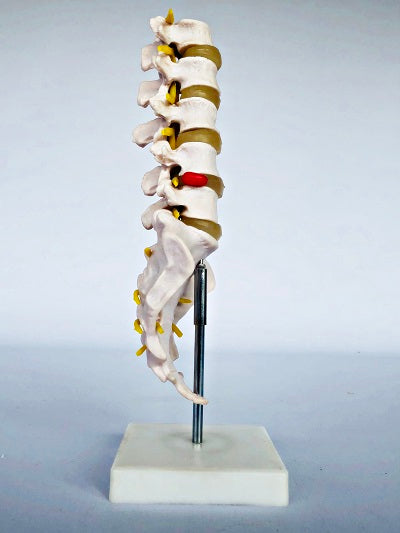 Lumbar Spine on stand IT019 3