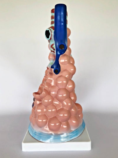 Magnified Pulmonary Model IT038 1