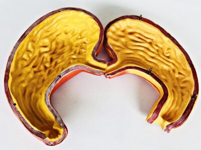 Stomach Model IT044 2