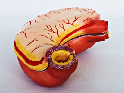 Stomach Model IT044 4
