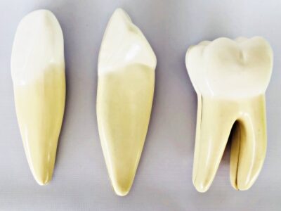 Teeth Expansion Model IT-043 1