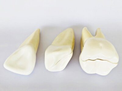 Teeth Expansion Model IT-043 2