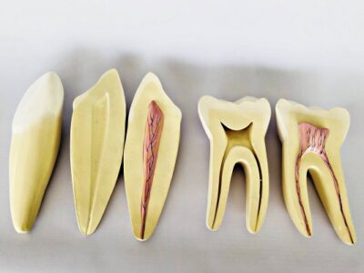 Teeth Expansion Model IT-043 3