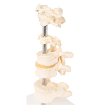 6 Mounted Vertebrae  A75 2