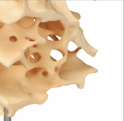 Cancellous Bone A99 2