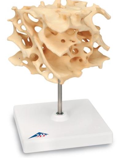 Cancellous Bone A99