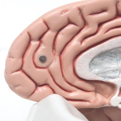Classic Brain, 5-Part   C18 4