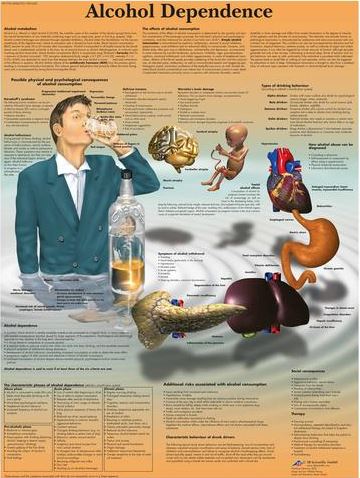 Alcohol Dependence Chart VR1792