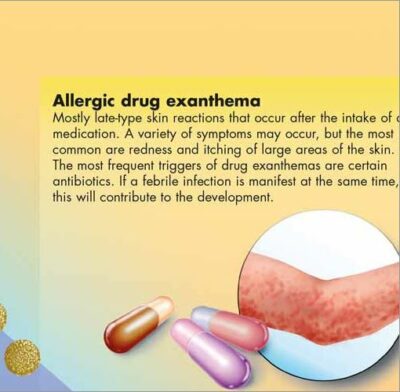 Allergies Chart VR1660 2