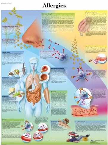 Allergies Chart VR1660