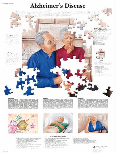 Alzheimer’s Disease Chart VR1628